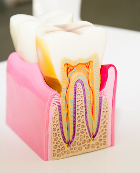 Model showing inside of tooth